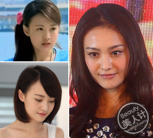 郑爽整容项目曝光