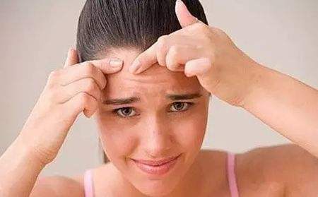 脸上长痘能用硫磺皂洗吗?